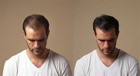 Ulti Paris™ The World's Most Efficient Hair Fiber