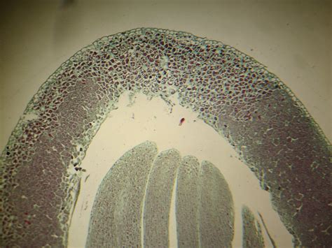 Pinus Mature Embryo