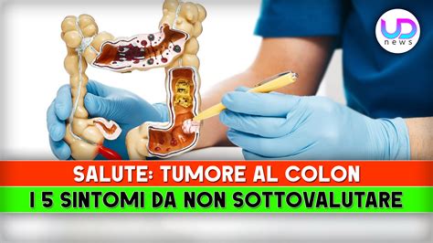 Tumore Al Colon Sintomi Da Non Sottovalutare