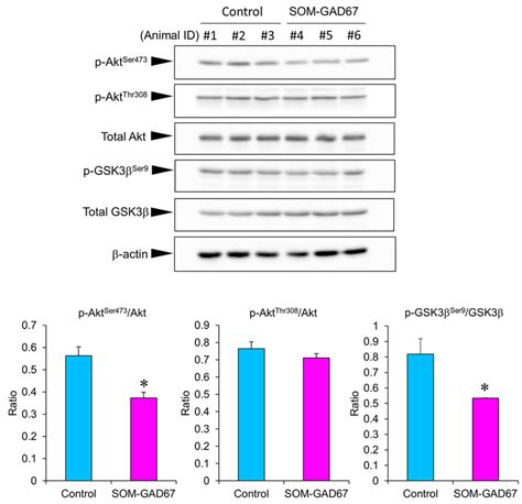 Protein Levels Of Akt And Glycogen Synthase Kinase 3 β Gsk3β In The