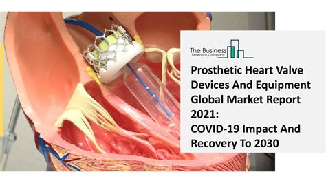 Prosthetic Heart Valve Devices And Equipment Market Growth Analysis