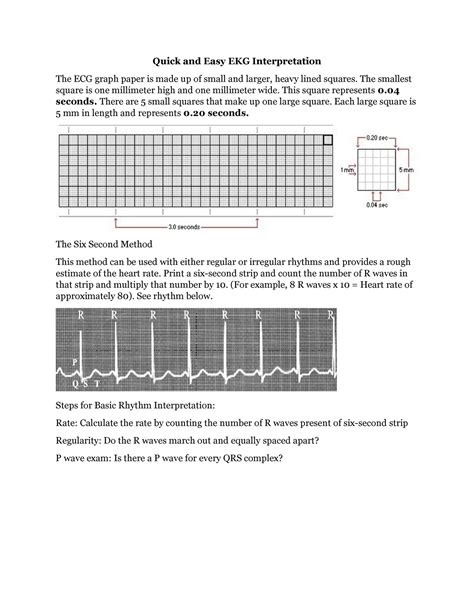 Ekg Interpretation Quick And Easy Ekg Interpretation The Ecg Graph