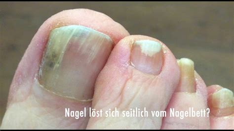 Nagel L St Sich Ab Youtube