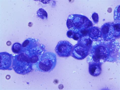 Anidap Cytologyosteosarcoma