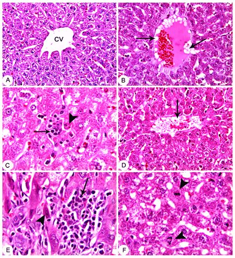 Liver Rabbit A Control Group Showing Normal Histological