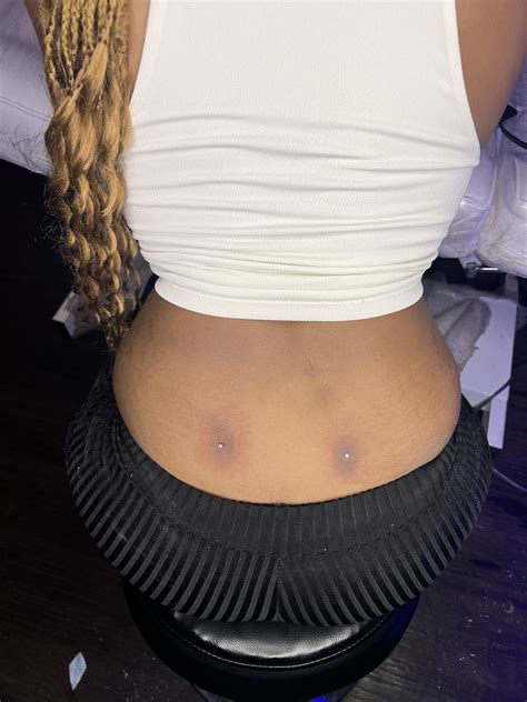 Back Dimples Piercing Infection