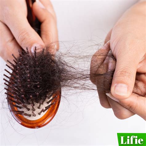 Surprising Reasons Your Hair Is Falling Out Lifie For Life Lifie Lk