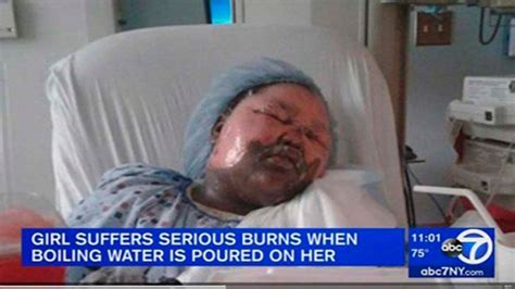 Hot water challenge el nuevo y peligroso desafío viral que ya mató a una niña Infobae