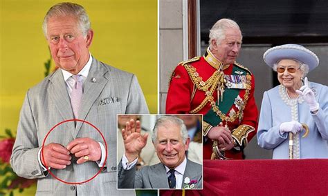 Doctor Reveals Why King Charles S Fingers Are So Swollen Daily Mail