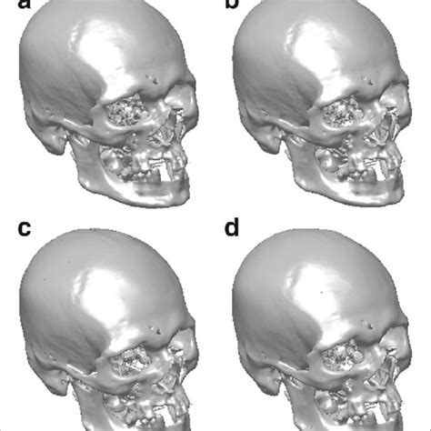 A R Results Of Sex Estimation Based On Orientation Of Region Partition Download Scientific