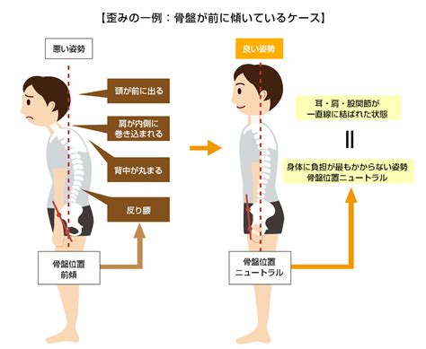 健康と骨盤と姿勢 京王線桜上水 うえた鍼灸整骨院 はれやか整骨院