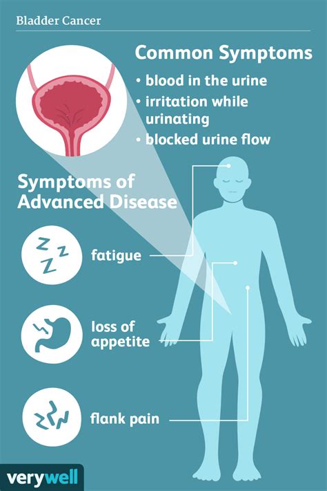 Signs And Symptoms Of Bladder Cancer