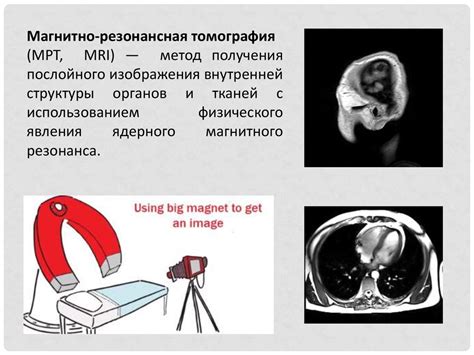 Магнитно-резонансная томография (МРТ) и функциональная магнитно ...