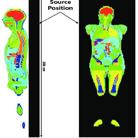 Icrp Reference Phantom And Source Position Llat With Source Position Download Scientific