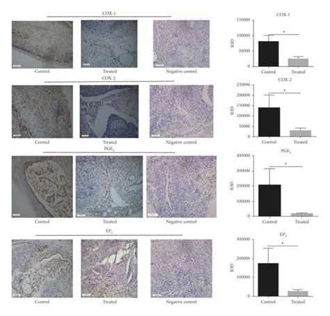 The Expression Of Cox 1 Cox 2 And Ep2 Mrna And The Expression Of