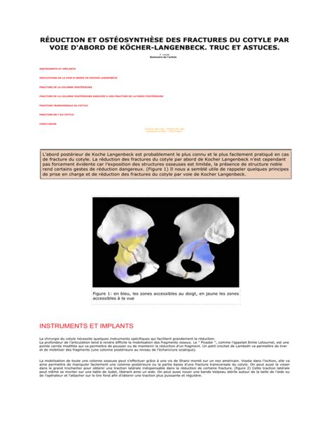 Traitement Chirurgical Des Fractures Du Cotyle Par Le Docteur Laude