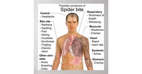 Symptoms Common in Poisonous Spider Bites Chart | Zazzle