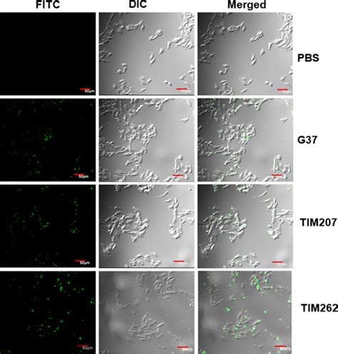 Microscopic Observation Of Adherenceinvasion Of M Genitalium Strains