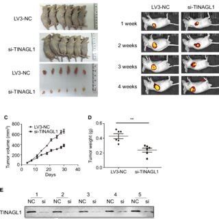 Effect Of Tinagl1 On The Growth Of Tumor In Nude Mice Notes A Tumor