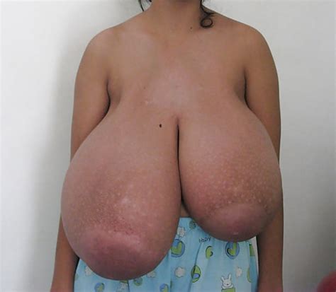 Macromastia Porn Pictures