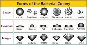 What is the Colony Morphology of Bacteria? Colony Characteristics - Biology Reader