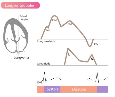 Bedömning av diastolisk funktion med ekokardiografi ekg nu