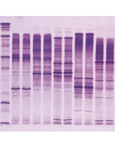 Serva Electrophoresis Biophoretics