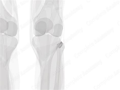 Superior Tibiofibular Joint (Left) | Complete Anatomy