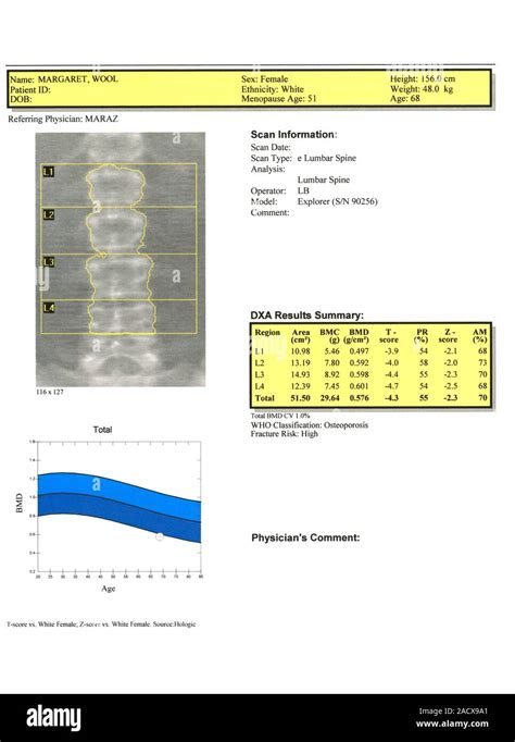 Dual Energy X Ray Absorptiometry DEXA Scan Of A 68 Year Old Female