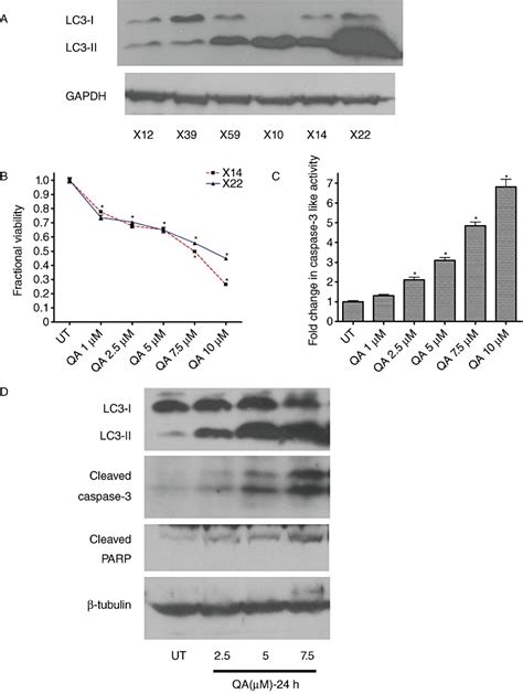 Assessment Of Baseline Level And Quinacrine Qa Induced Autophagy And