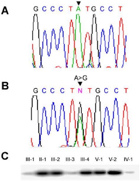 Mutation Analysis Of The FOXL2 Gene A Sequencing Chromatogram Of The