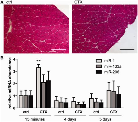 Ctx Injury Induces Release Of Serum Dystromirs The 8 Week Old Male