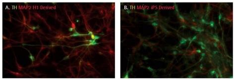 Robust Differentiation Of Human Ipscs Into Lineage Specific Neurons And