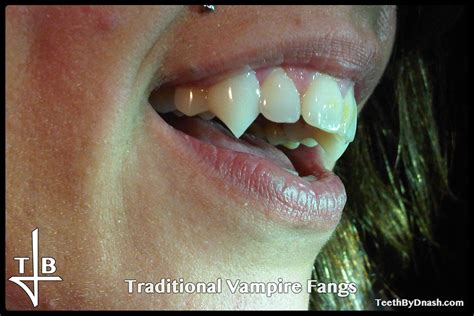 Traditional Vampire Teeth By Dnash