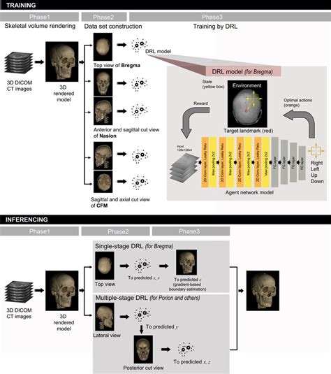 Schematic Diagram Of The Proposed 3d Cephalometric Landmark Detection