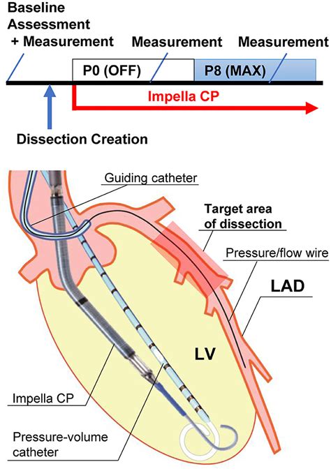 Frontiers Novel Porcine Model Of Coronary Dissection Reveals The