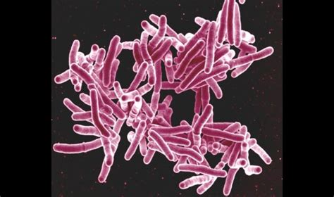 First Map Of TB Bacteria Proteome Asian Scientist Magazine