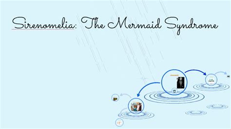 Sirenomelia The Mermaid Syndrome By Bailey Stedman On Prezi