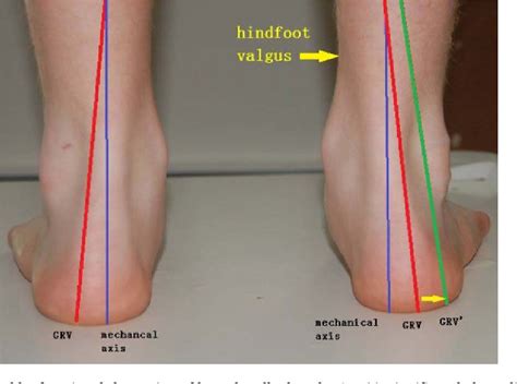 Figure From Ground Reaction Vector Re Adjustment The Secret Of