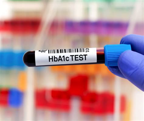 Hemoglobin A1c Dış Kalite Kontrol Programı Turqas Quality Control