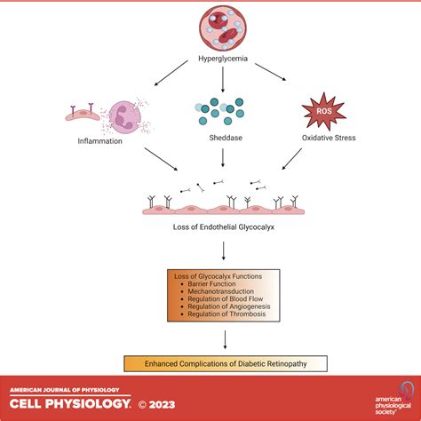 Diabetic Macular Edema Pathophysiology