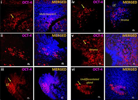 Expansion Of Endometrial Stem Progenitor Cells Compartment After