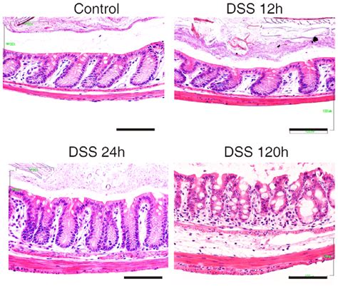 Histology of mouse colon stained with Haematoxylin/ Eosin for different ...