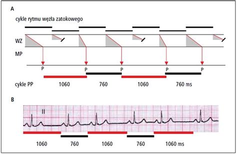 Rytm zatokowy w zdrowiu i w chorobie dużo znaków zapytania Polecane