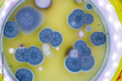 colony of skin fungi in a petri dish Stock Photo | Adobe Stock