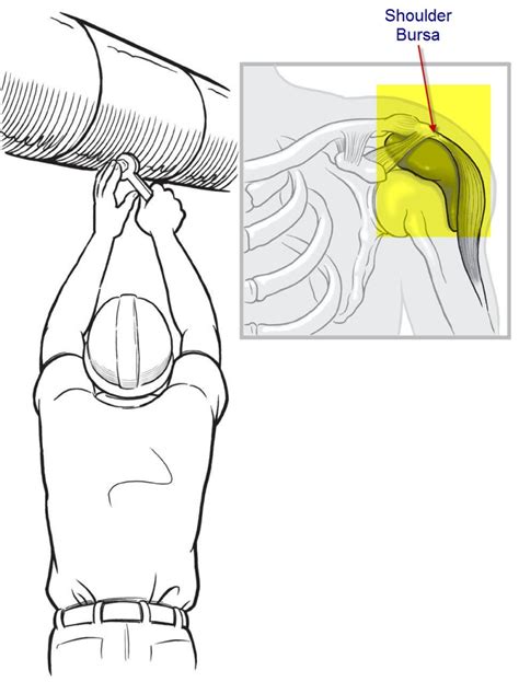 shoulder bursa | The Disabled List