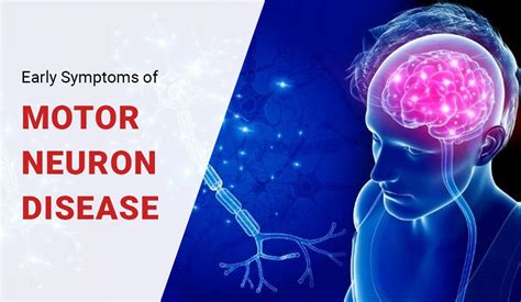 Early Symptoms Of Motor Neuron Disease MND Advancells