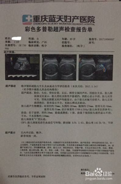 一分钟教你如何看懂孕期b超检查单 百度经验