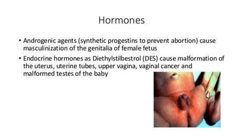 Birth Defects And Prenatal Diagnosis