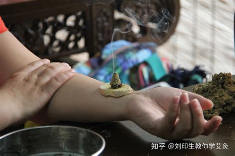 传统艾灸四大灸法简述 知乎